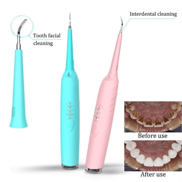 Dental Care Calculus Remover