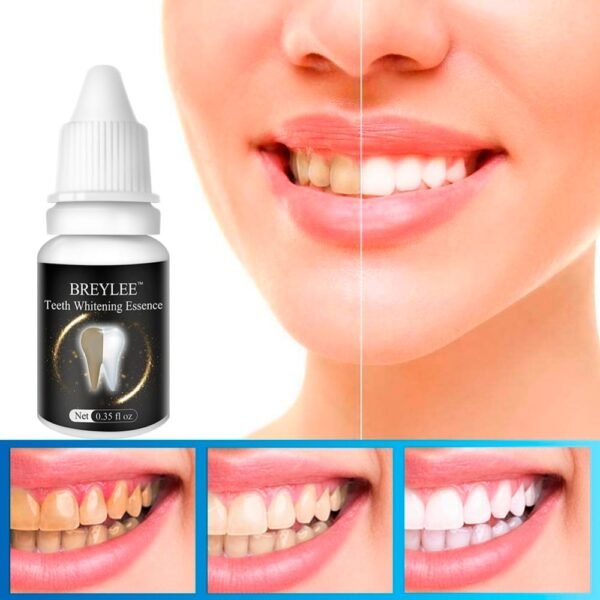 Instant Teeth Whitening Essence - Natural Plant Extract - Image 4