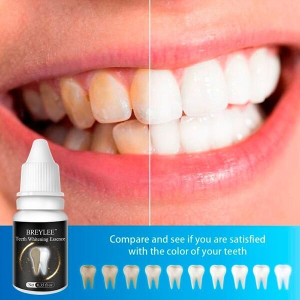 Instant Teeth Whitening Essence - Natural Plant Extract - Image 5